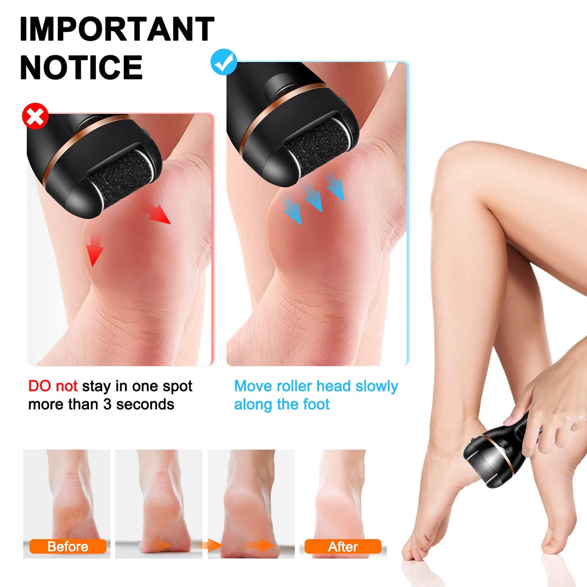 Dead Skin Removal Electric Pedicure Machine